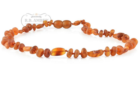 Image of Baltic Amber Necklace for Children - CLEARANCE - Screw Clasp Teething Jewelry R.B. Amber Jewelry 12-13 inches Raw Cognac Mix 